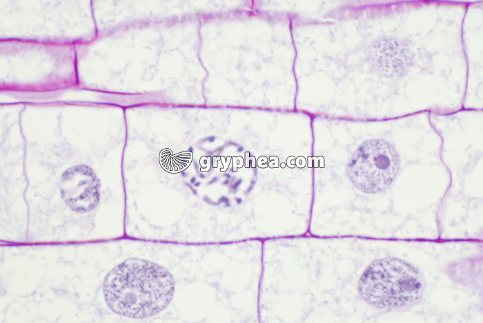 Mitose dans une racine de Blé (cellule en prophase) x200 - gryphea.com
